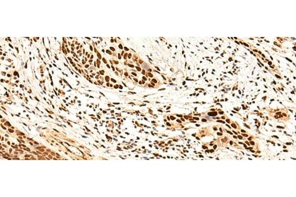 METTL1 antibody