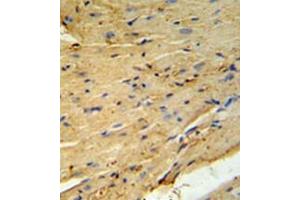 Immunohistochemistry analysis in formalin fixed and paraffin embedded mouse heart tissue using PLB-Thr17 followed by peroxidase conjugation of the secondary antibody and DAB staining. (Phospholamban antibody  (Thr17))