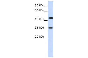 Western Blotting (WB) image for anti-Zinc Finger Protein 684 (ZNF684) antibody (ABIN2458119) (ZNF684 antibody)