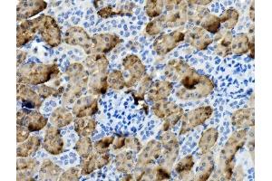 IHC analysis of PCK1/PEPC using anti-PCK1/PEPC antibody (ABIN7599502). (PCK1 antibody  (AA 1-622))