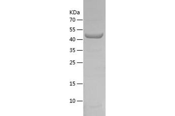 P4HA1 Protein (AA 340-534) (His-IF2DI Tag)