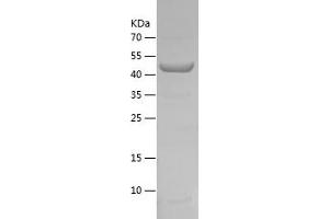 Western Blotting (WB) image for Prolyl 4-Hydroxylase, alpha Polypeptide I (P4HA1) (AA 340-534) protein (His-IF2DI Tag) (ABIN7124598) (P4HA1 Protein (AA 340-534) (His-IF2DI Tag))