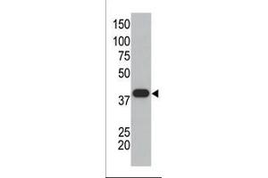 The anti-SUMO1 polyclonal antibody (ABIN388027 and ABIN2845493) is used in Western blot to detect GST-SUMO1 fusion protein. (SUMO1 antibody  (C-Term))