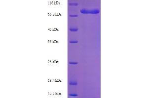 SDS-PAGE (SDS) image for Electron-Transferring-Flavoprotein Dehydrogenase (ETFDH) (AA 34-617) protein (His-SUMO Tag) (ABIN5711279)