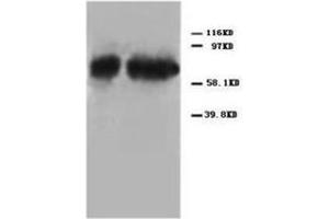 Western blot analysis of Hela cell lysis using P73alpha antibody (Tumor Protein p73 antibody  (C-Term))