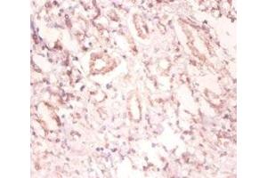 Immunohistochemistry of paraffin-embedded human kidney tissue using ABIN7174131 at dilution of 1:100 (SNRPA1 antibody  (AA 8-278))