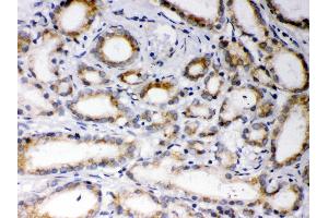 Anti- EBAG9 Picoband antibody,IHC(P) IHC(P): Human Prostatic Cancer Tissue (RCAS1 antibody  (AA 31-213))