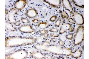 Anti- EBAG9 Picoband antibody,IHC(P) IHC(P): Human Prostatic Cancer Tissue