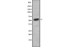 Western blot analysis of V-ATPase H using HuvEc whole cell lysates