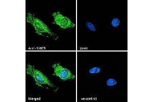 (ABIN570758) Immunofluorescence analysis of paraformaldehyde fixed HeLa cells, permeabilized with 0. (SMC5 antibody  (Internal Region))