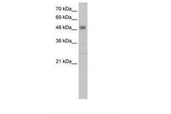 RSAD2 antibody  (C-Term)