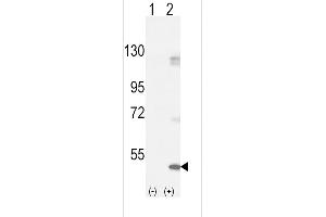 Western blot analysis of FGFR1 using rabbit polyclonal FGFR1-pY154 using 293 cell lysates (2 ug/lane) either nontransfected (Lane 1) or transiently transfected with the FGFR1 gene (Lane 2). (FGFR1 antibody  (AA 132-161))