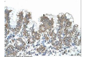 Image no. 1 for anti-Salt-Inducible Kinase 1 (SIK1) (N-Term) antibody (ABIN321003) (SIK1 antibody  (N-Term))