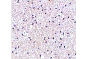 Immunohistochemistry of MORF4 in human brain tissue with MORF4 antibody at 5 μg/ml.