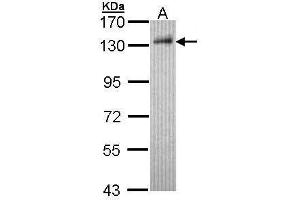 WB Image Sample (30 ug of whole cell lysate) A: Hep G2 , 7. (DDB1 antibody  (C-Term))