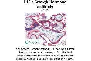 Image no. 1 for anti-Growth Hormone 1 (GH1) antibody (ABIN1735292) (Growth Hormone 1 antibody)