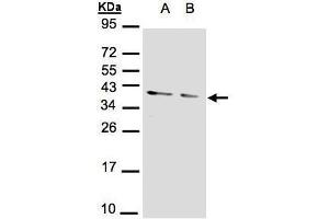 WB Image Sample(30 μg of whole cell lysate) A:293T B:A431, 12% SDS PAGE antibody diluted at 1:1000 (PPP1CA antibody  (Center))