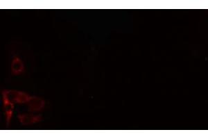 ABIN6274211 staining 293 cells by IF/ICC. (PTX3 antibody  (N-Term))