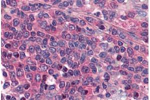 Human Spleen (formalin-fixed, paraffin-embedded) stained with PTGER1 antibody ABIN297511 at 2. (PTGER1 antibody  (AA 248-260))