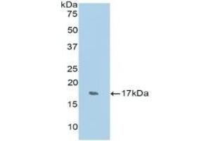 Detection of Recombinant RNASE7, Human using Polyclonal Antibody to Ribonuclease A7 (RNASE7) (RNASE7 antibody  (AA 31-155))