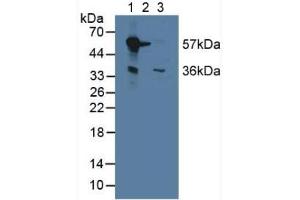 Western blot analysis of (1) Mouse Liver Tissue, (2) Mouse Brain Tissue and (3) Mouse Kidney Tissue. (Monoamine Oxidase B antibody  (AA 206-505))