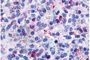 Anti-P2RY13 / P2Y13 antibody  ABIN1049210 IHC staining of human spleen. (Purinergic Receptor P2Y, G-Protein Coupled, 13 (P2RY13) (Extracellular Domain) antibody)