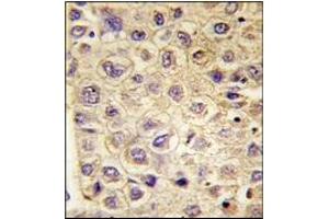 Immunohistochemistry (IHC) image for anti-TYRO3 Protein Tyrosine Kinase (TYRO3) antibody (ABIN356409) (TYRO3 antibody)