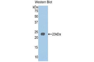Western Blotting (WB) image for anti-Homogentisate 1,2-Dioxygenase (HGD) (AA 239-428) antibody (ABIN1859143) (HGD antibody  (AA 239-428))