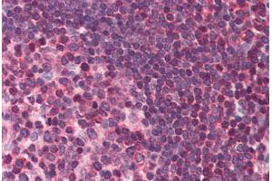 Human Small Intestine, Peyer's Patch (formalin-fixed, paraffin-embedded) stained with DAPK3 antibody ABIN214482 at 2. (DAPK3 antibody  (Internal Region))