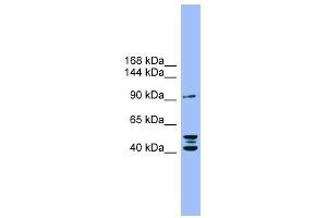 ENPP2 antibody used at 1 ug/ml to detect target protein. (ENPP2 antibody  (N-Term))