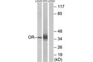 Western blot analysis of extracts from LOVO/NIH-3T3 cells, using OR4D6 Antibody. (OR4D6 antibody  (AA 260-309))