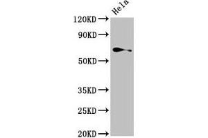 Western Blot Positive WB detected in: Hela whole cell lysate All lanes: TRIP4 antibody at 4 μg/mL Secondary Goat polyclonal to rabbit IgG at 1/50000 dilution Predicted band size: 67 kDa Observed band size: 67 kDa (TRIP4 antibody  (AA 360-535))