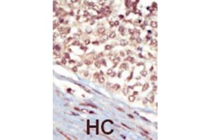 Immunohistochemistry (IHC) image for anti-EPH Receptor A5 (EPHA5) antibody (ABIN3003333) (EPH Receptor A5 antibody)