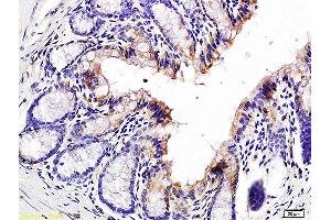Formalin-fixed and paraffin embedded mouse colon labeled with Anti-Jagged1/CD339 Polyclonal Antibody, Unconjugated (ABIN686677) at 1:200 followed by conjugation to the secondary antibody and DAB staining. (JAG1 antibody)