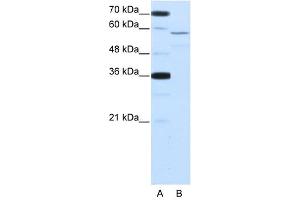 NOVA2 antibody used at 2. (NOVA2 antibody  (Middle Region))