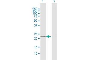 Western Blot analysis of PGDS expression in transfected 293T cell line by PGDS MaxPab polyclonal antibody. (PTGDS antibody  (AA 1-199))