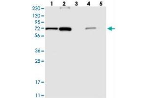 Western blot analysis of Lane 1: RT-4, Lane 2: U-251 MG, Lane 3: Human Plasma, Lane 4: Liver, Lane 5: Tonsil with AGPS polyclonal antibody  at 1:250-1:500 dilution. (AGPS antibody)