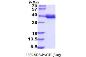 SDS-PAGE (SDS) image for Coenzyme Q9 Homolog (COQ9) (AA 45-318) protein (His tag) (ABIN5778671)