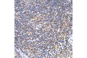 Immunohistochemistry (IHC) image for anti-Peroxisome Proliferator-Activated Receptor gamma (PPARG) (AA 50-150) antibody (ABIN3020844)