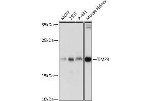 Western blot analysis of extracts of various cell lines, using TIMP3 antibody (ABIN6134857, ABIN6149180, ABIN6149181 and ABIN6215546) at 1:1000 dilution. (TIMP3 antibody  (C-Term))