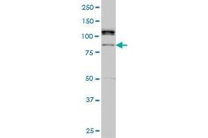ALS2CR8 monoclonal antibody (M01), clone 2A3 Western Blot analysis of ALS2CR8 expression in Hela S3 NE . (Calcium Responsive Transcription Factor (CARF) (AA 621-718) antibody)