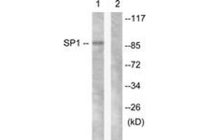 Western blot analysis of extracts from LOVO cells, using SP1 (Ab-453) Antibody. (SP1 antibody  (AA 421-470))