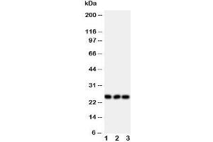Western blot testing of FGF19 antibody and Lane 1:  rat brain;  2: U87;  3: SMMC-7721 cell lysate (FGF19 antibody  (Middle Region))