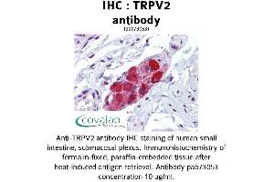 Image no. 1 for anti-Transient Receptor Potential Cation Channel, Subfamily V, Member 2 (TRPV2) (AA 595-764) antibody (ABIN1740401) (TRPV2 antibody  (AA 595-764))