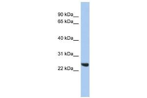 PSMB2 antibody used at 1 ug/ml to detect target protein. (PSMB2 antibody)