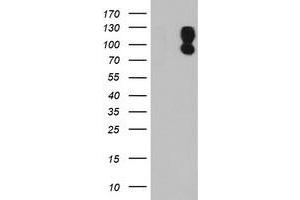 HEK293T cells were transfected with the pCMV6-ENTRY control (Left lane) or pCMV6-ENTRY DPP9 (Right lane) cDNA for 48 hrs and lysed. (DPP9 antibody)