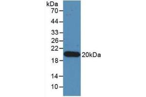 Western blot analysis of recombinant Human IL17. (IL-17 antibody  (AA 20-155))