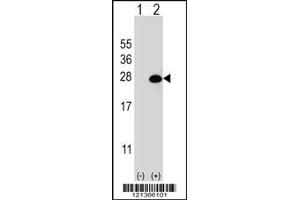 Western blot analysis of DGCR6L using rabbit polyclonal DGCR6L Antibody using 293 cell lysates (2 ug/lane) either nontransfected (Lane 1) or transiently transfected (Lane 2) with the DGCR6L gene. (DGCR6L antibody  (AA 108-135))