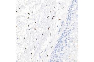 Immunohistochemistry of paraffin-embedded human cervix using Progesterone Receptor Rabbit mAb (ABIN7269533) at dilution of 1:100 (40x lens). (Progesterone Receptor antibody)