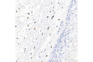 Immunohistochemistry of paraffin-embedded human cervix using Progesterone Receptor Rabbit mAb (ABIN7269533) at dilution of 1:100 (40x lens).